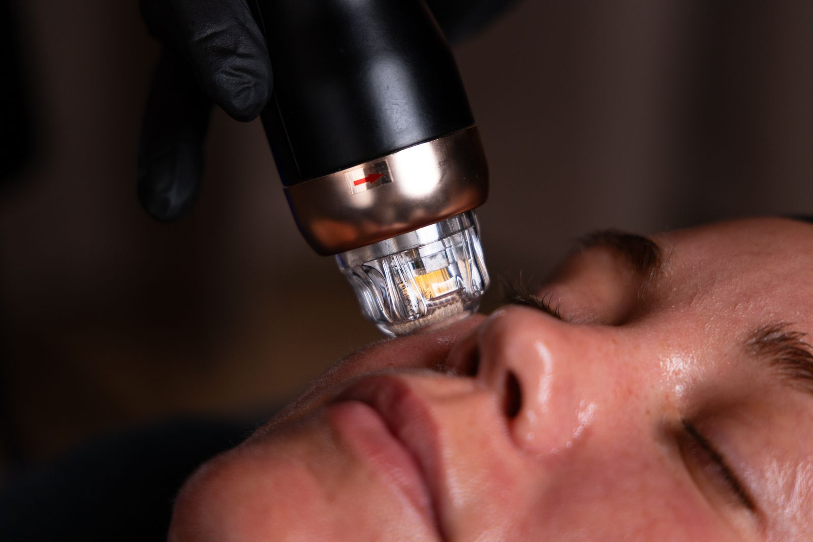 The handpiece