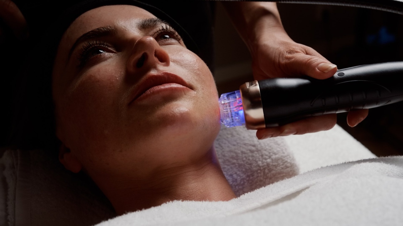 RF Microneedling treatment on the face